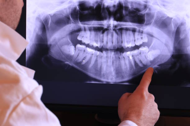 Best Dental Abscess Treatment in Gotha, FL